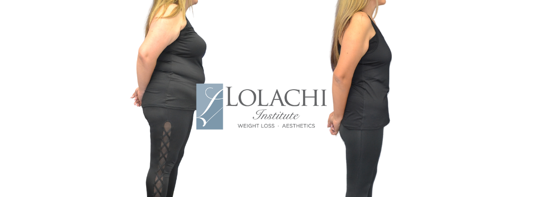 Semaglutide Weight Loss – Lolachi Institute