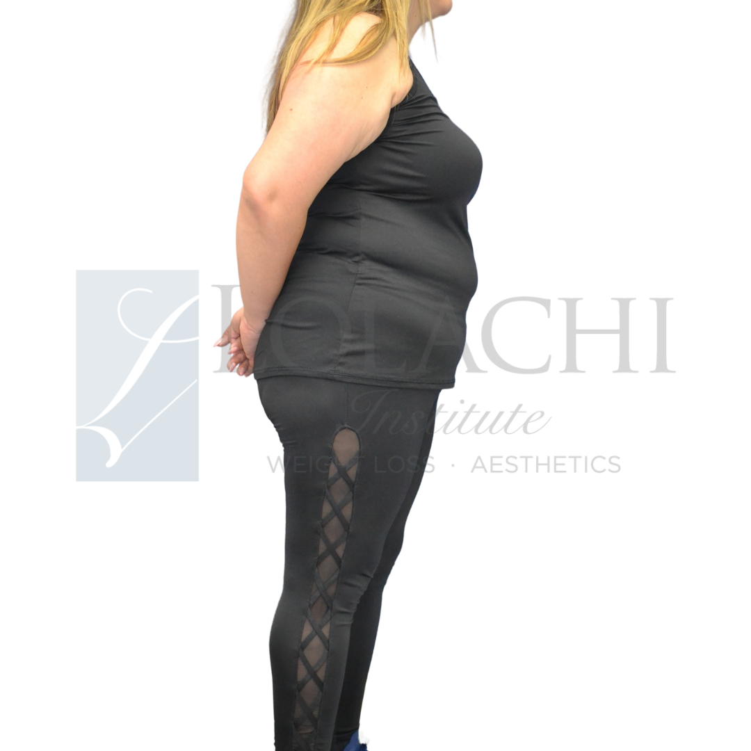 before weight loss